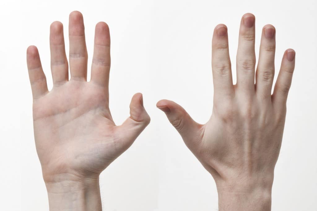 "Human-Hands-Front-Back" by Evan-Amos - Own work. Licensed under CC BY-SA 3.0 via Wikimedia Commons - http://commons.wikimedia.org/wiki/File:Human-Hands-Front-Back.jpg#/media/File:Human-Hands-Front-Back.jpg
